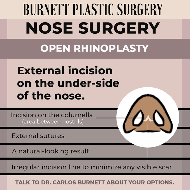 See what sets an open rhinoplasty apart at Westfield, NJ's Burnett Plastic Surgery.